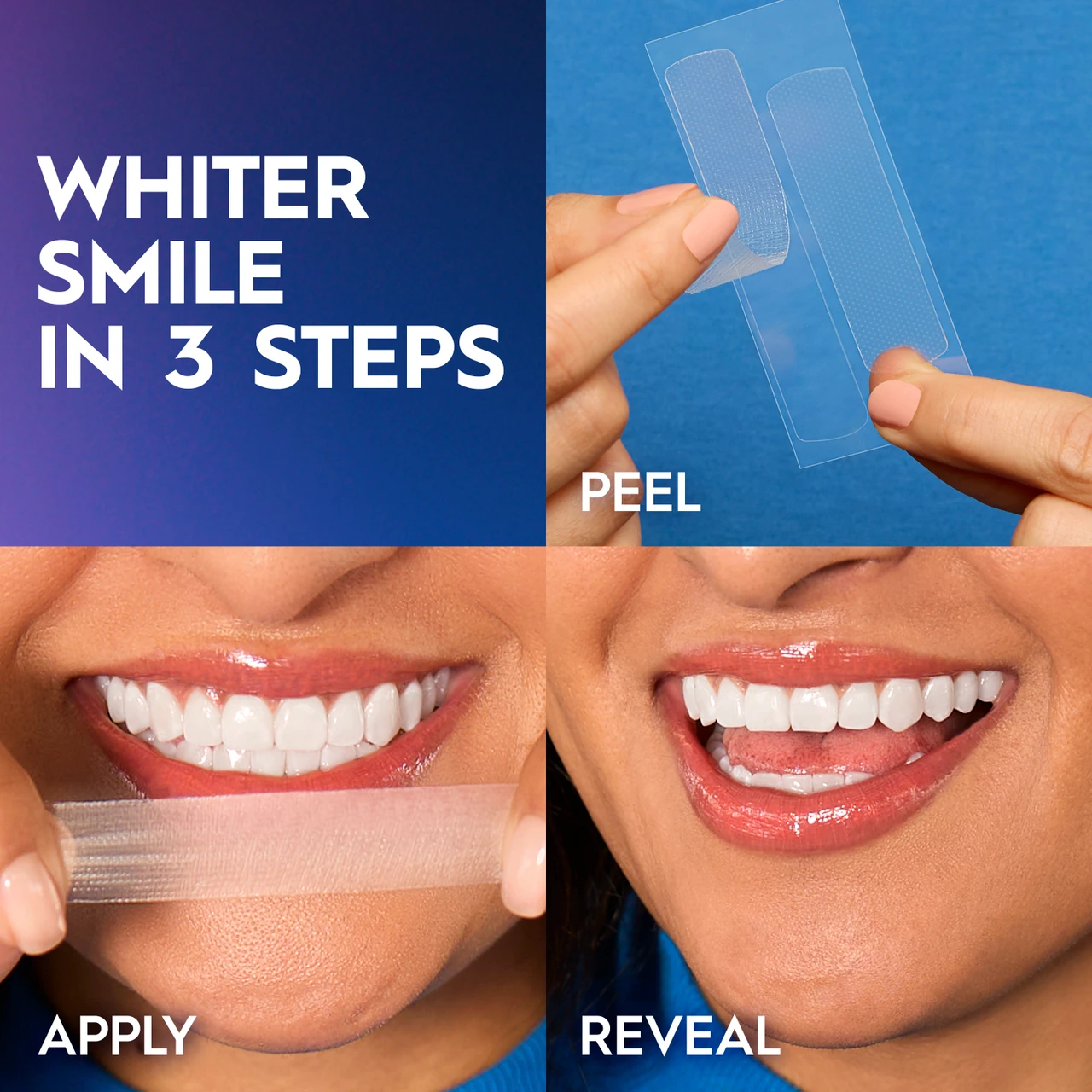 Crest 3DWhitestrips 1 Week Smile Transformation - Image 5
